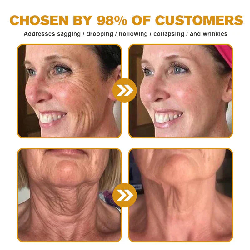 ✅ LOVILDS Bee Venom Wrinkle Removal Cream – LAST DAY 60% OFF