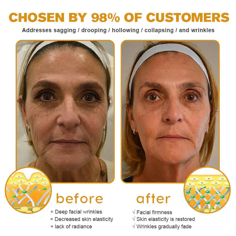 ✅ LOVILDS Bee Venom Wrinkle Removal Cream – LAST DAY 60% OFF