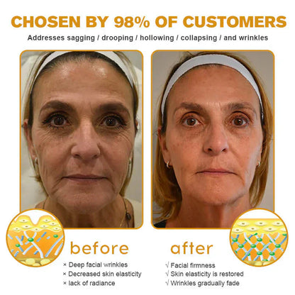 ✅ LOVILDS Bee Venom Wrinkle Removal Cream – LAST DAY 60% OFF